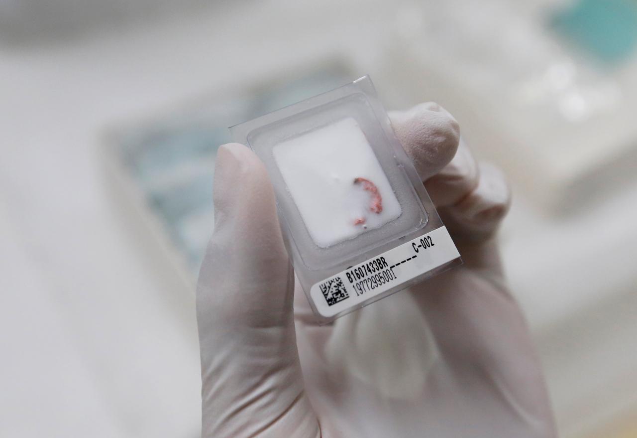 a research associate takes out a clinical sample cancer cell from  150 degree c ultra low temperature freezer at the bioresource research center of tokyo medical and dental university in tokyo japan july 21 2016 photo reuters