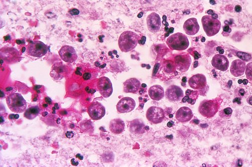 naegleria fowleri stock photo