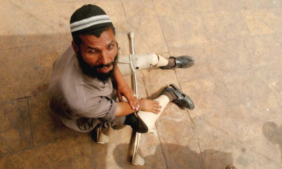 the man who takes his legs to market with a heavy heart