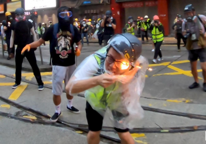 hong kong journalist hit by petrol bomb recovering in hospital hong kong journalist hit by petrol bomb recovering in hospital