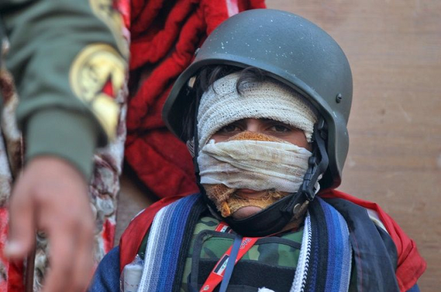 an injured iraqi protester takes part in anti government demonstration on al ahrar bridge in baghdad photo afp an injured iraqi protester takes part in anti government demonstration on al ahrar bridge in baghdad photo afp