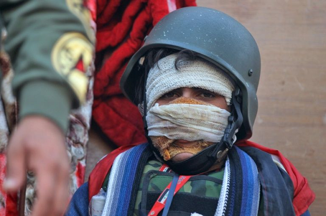 an injured iraqi protester takes part in anti government demonstration on al ahrar bridge in baghdad photo afp