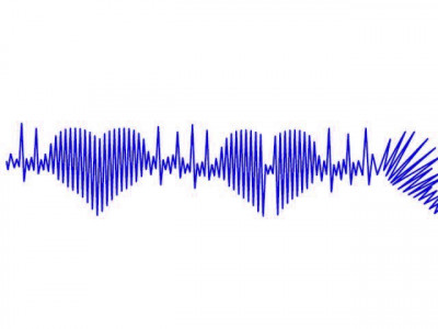 heart attack men at a higher risk than women