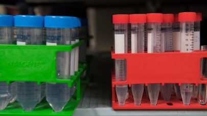 lab results of 15 million canadians hacked