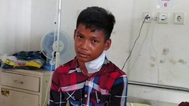 indonesian teenager muhammad idul says fish leapt out of the sea and speared him through the neck photo courtesy bbc