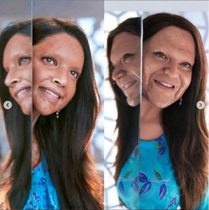 shoaib khan recreates deepika padukone s look from chhapaak