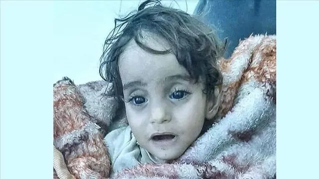 18 month old girl breathed her last before reaching health centre in afrin photo anadolu agency 18 month old girl breathed her last before reaching health centre in afrin photo anadolu agency