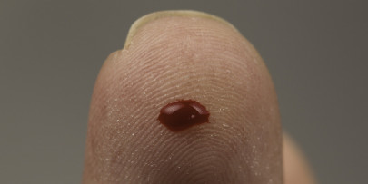 judge to undergo dna test