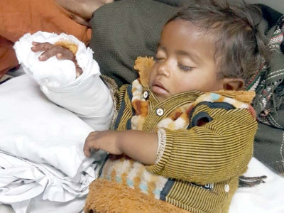 replantation miracle surgeons reattach child s hand replantation miracle surgeons reattach child s hand