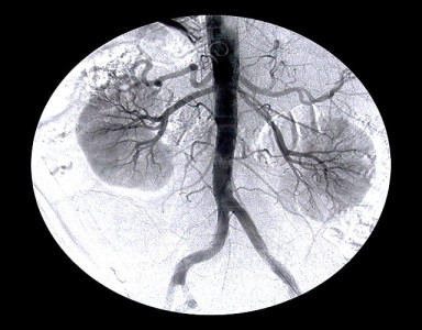 lgh hosts workshop on kidney surgery