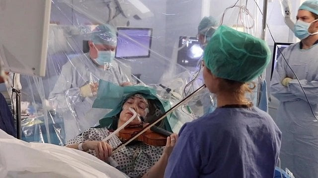 surgeons came up with the idea to ensure areas of turner 039 s brain responsible for hand movements were not affected photo afp surgeons came up with the idea to ensure areas of turner 039 s brain responsible for hand movements were not affected photo afp