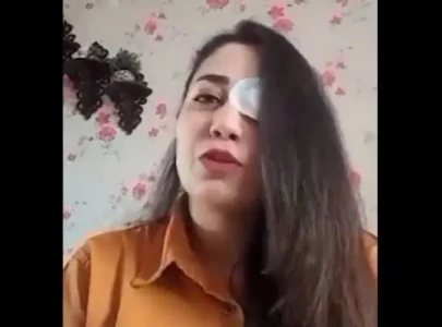 iran forces targeting eyes of protesters rights group