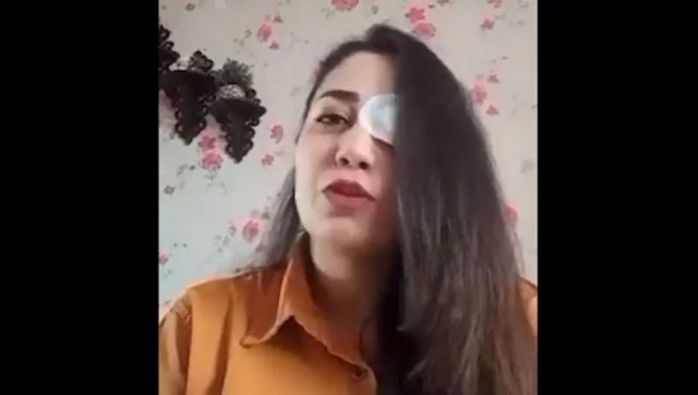 iran forces targeting eyes of protesters rights group