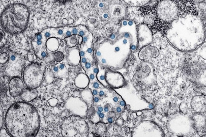 kenya confirms first case of coronavirus in east africa kenya confirms first case of coronavirus in east africa