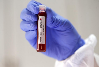 coronavirus testing capacity triples at indus hospital coronavirus testing capacity triples at indus hospital