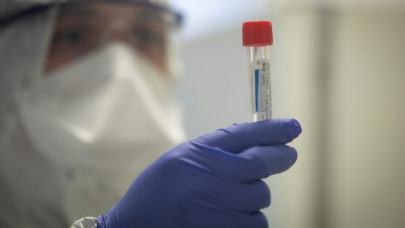 china embarks on clinical trial for coronavirus vaccine china embarks on clinical trial for coronavirus vaccine