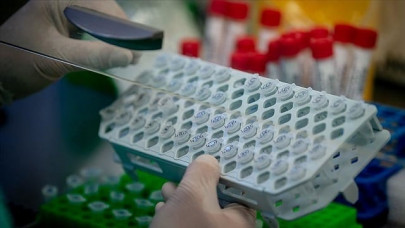 russia recommends lopinavir ritonavir against covid 19 russia recommends lopinavir ritonavir against covid 19