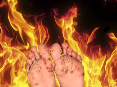 only in pakistan setting an 11 year old girl on fire to treat typhoid