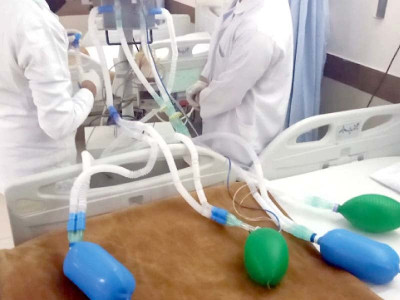 ric develops stopgap measure to bridge ventilator shortage