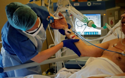 coronavirus intensive care    what is involved coronavirus intensive care    what is involved