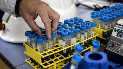 france begins clinical trials of coronavirus blood plasma treatment france begins clinical trials of coronavirus blood plasma treatment