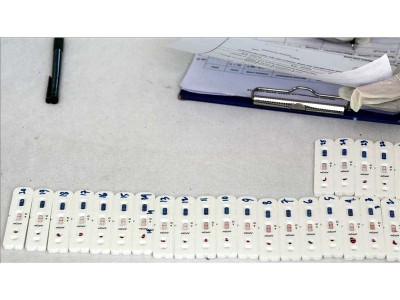 worldwide coronavirus cases jump to 1 5 million worldwide coronavirus cases jump to 1 5 million