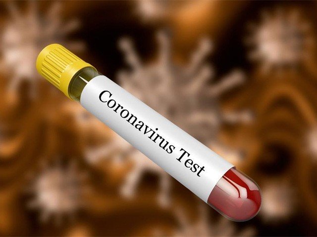 petition filed in lhc for free covid 19 tests