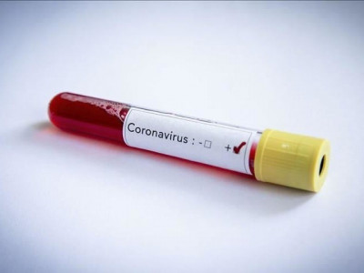 somali state minister dies of coronavirus