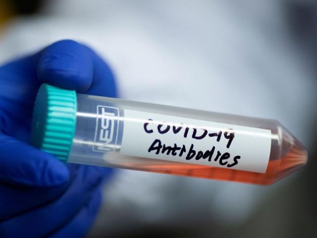 a scientist shows a tube with a solution containing covid 19 antibodies in his lab where he works on research into novel coronavirus disease covid 19 antibodies for possible use in a drug at tsinghua university 039 s research center for public health in beijing china photo reuters