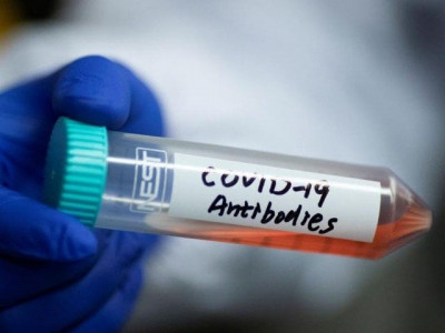 nibd s passive immunisation technique gets us drug agency s nod for clinical trials nibd s passive immunisation technique gets us drug agency s nod for clinical trials