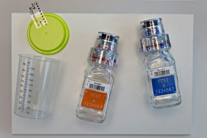 k p starts pool testing for coronavirus k p starts pool testing for coronavirus