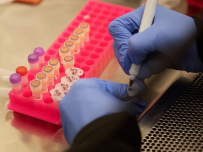 us fda warns against malaria drugs trump championed for covid 19