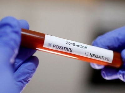 three doctors cop test positive for covid 19 in abbottabad three doctors cop test positive for covid 19 in abbottabad