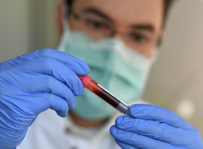 germany s confirmed coronavirus cases rise by 2 055 to 152 438 rki