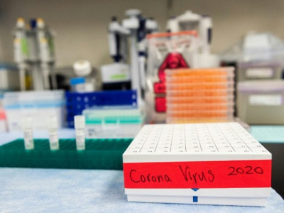 karachi university team identifies potential drugs for covid 19 treatment karachi university team identifies potential drugs for covid 19 treatment