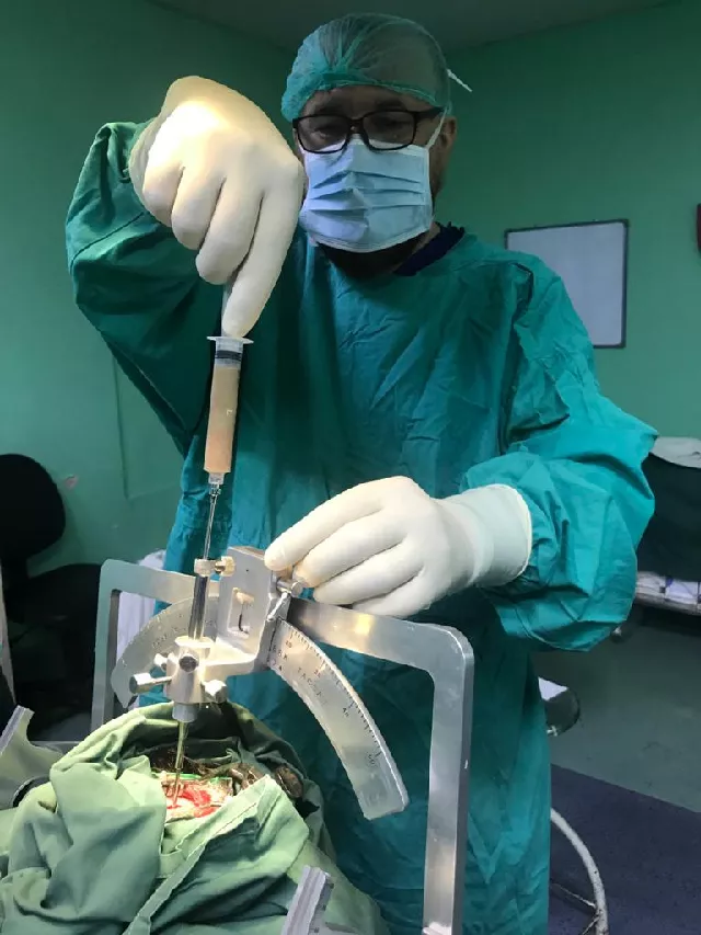 under the procedure a tiny hole was drilled and 200 mm tumor was extracted from young boy 039 s brain photo express