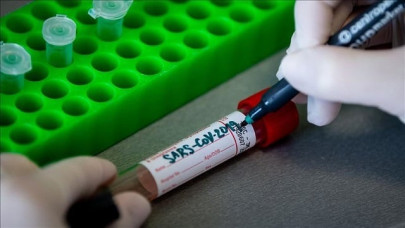 coronavirus cases worldwide surpass 4 1 million coronavirus cases worldwide surpass 4 1 million