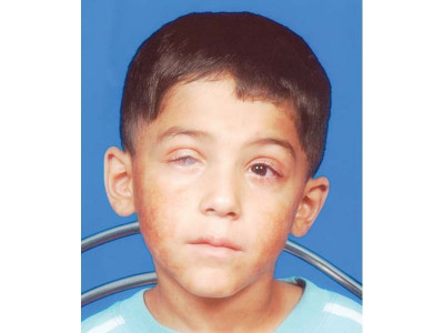 precious lives losing sight to negligent treatment apathetic institutions