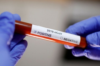 45 test positive for virus in mianwali