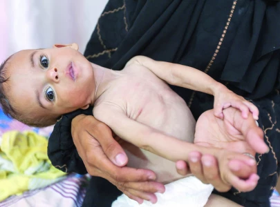 starvation grips gaza as food crisis deepens