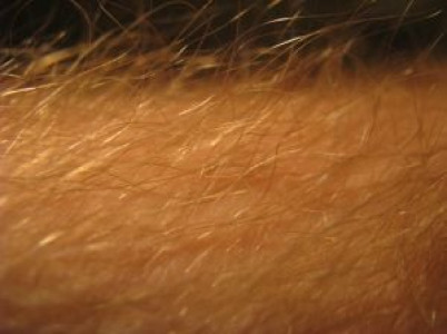 derma deficiency in pindi take special care of your skin derma deficiency in pindi take special care of your skin