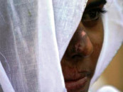 acid attacks leave lasting scars in faisalabad acid attacks leave lasting scars in faisalabad