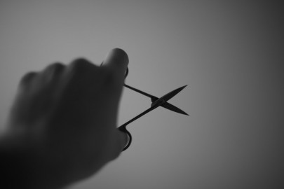 scissors removed from abdomen after year scissors removed from abdomen after year