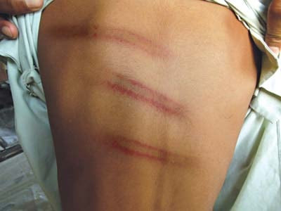 inhumane treatment for falling ill teacher thrashes student