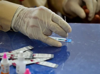 poor screening driving hiv surge experts