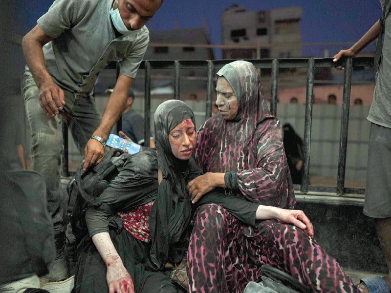 women injured during israeli bombardment arrive at the emergency ward at al nassr hospital in khan yunis photo afp