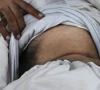 man blames friend for kidney theft man blames friend for kidney theft