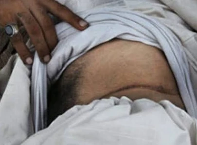 man blames friend for kidney theft man blames friend for kidney theft