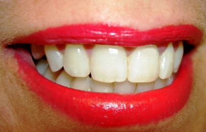 keep smiling to look young