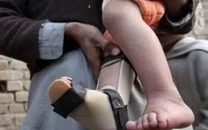 pakistan built a world class polio system then 40 000 karachi families said no